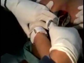 dildos. a video in which a girl is undergoing surgery to remove a sex toy from her anus
